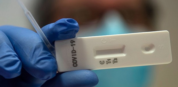 approves-coronavirus-testing-kits