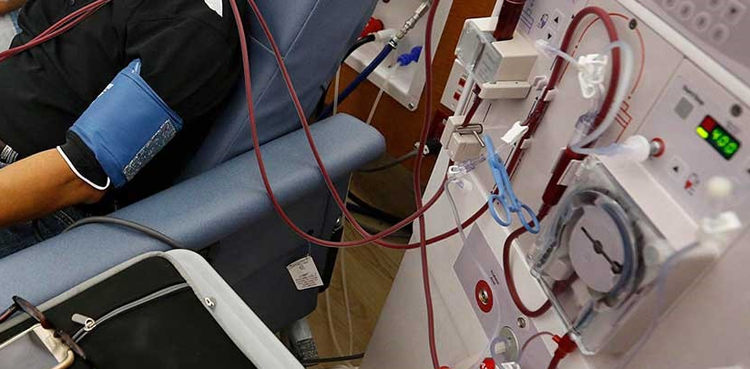risk-free-bloodless-dialysis-machine