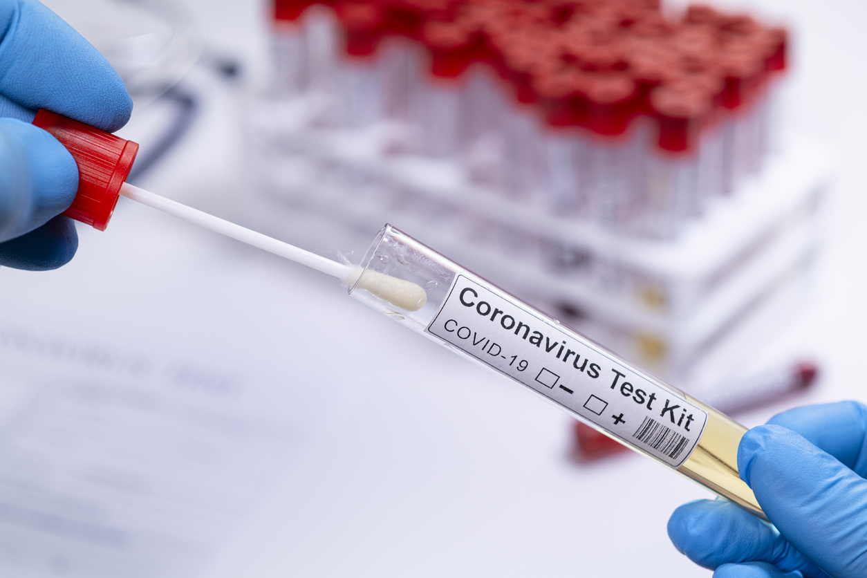 coronavirus-5