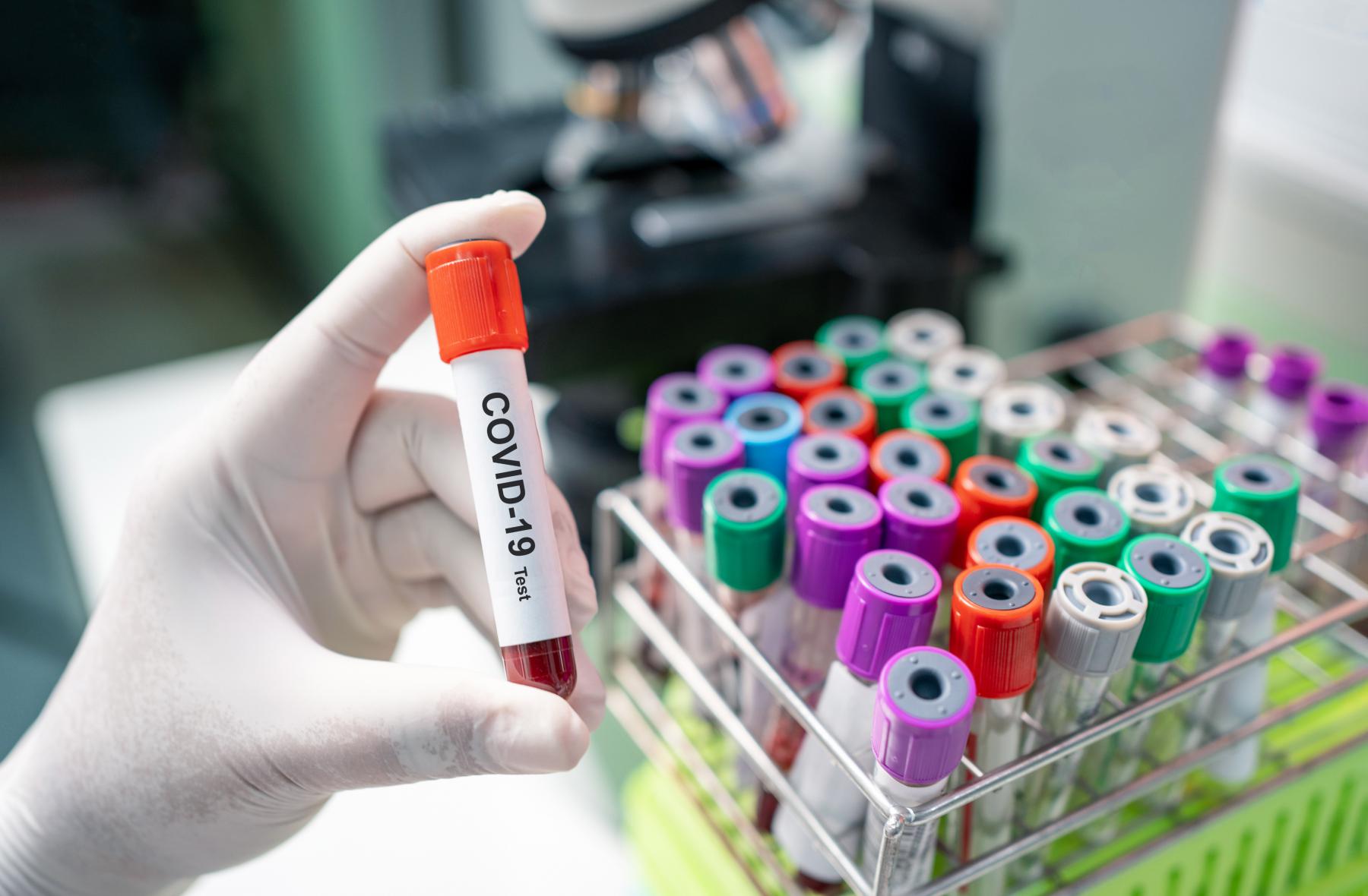 cases-of-coronavirus