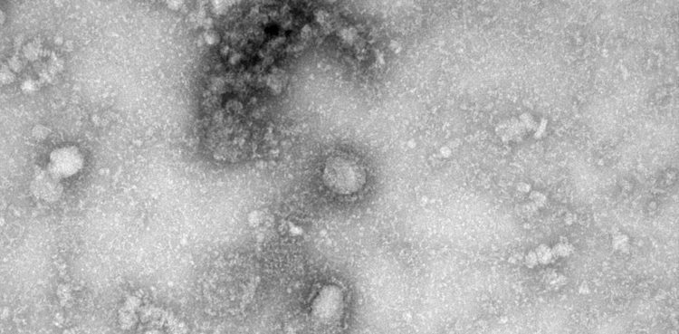 coronavirus-toll-jumps-to-722-after-86-deaths-in-a-single-day