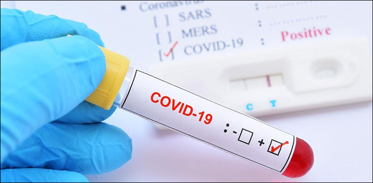 1666-new-coronavirus-cases