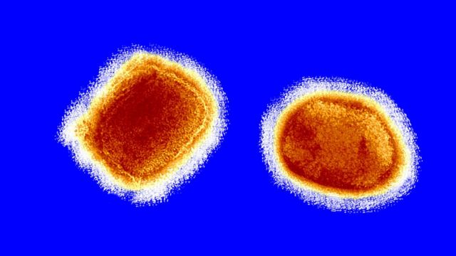 israel-switzerland-and-austria-confirm-monkeypox-cases