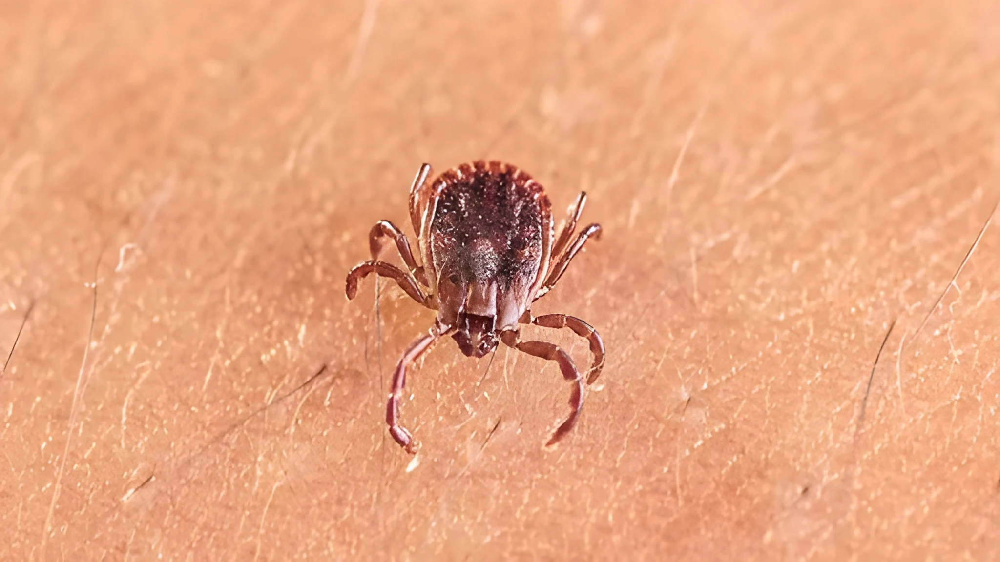 scientists-discover-new-tickborne-virus-causing-undiagnosed-flulike-symptoms