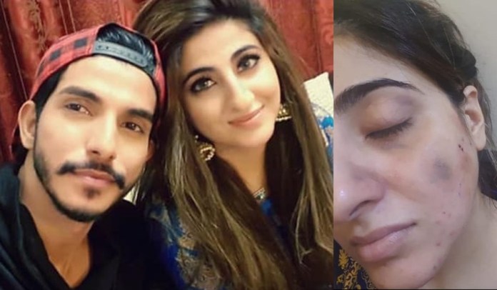 wife-of-mohsin-abbas-haider-comes-forth-with-shocking-domestic-violence-allegations